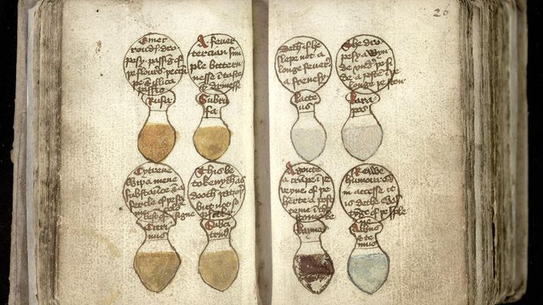Undated handout photo issued by Cambridge University Library of drawings of urine flasks, illustrating the different colours of a patient's urine, with their ailments described in roundels above. Curious medieval cures, including a treatment for gout that involved baking an owl then grinding it into a powder, are to be shared with the public online by Cambridge University Library. Issue date: Wednesday August 17, 2022. 